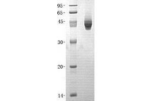 Image no. 1 for Protein Phosphatase, Mg2+/Mn2+ Dependent, 1A (PPM1A) (Transcript Variant 1) protein (His tag) (ABIN2729792)