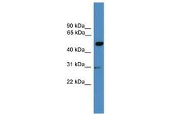 GAL3ST3 Antikörper  (AA 201-250)