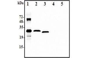 Image no. 3 for anti-Interleukin 37 (IL37) antibody (ABIN1169178)