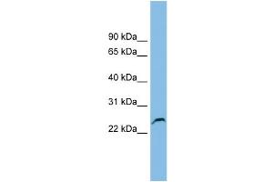 Image no. 1 for anti-Glutathione S-Transferase kappa 1 (GSTK1) (Middle Region) antibody (ABIN2786155)