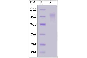 Human CD45, His Tag on  under reducing (R) condition.