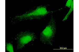 Immunofluorescence of monoclonal antibody to PCGF6 on HeLa cell.