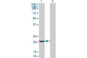 Western Blot analysis of SSSCA1 expression in transfected 293T cell line by SSSCA1 monoclonal antibody (M03), clone 2H4.