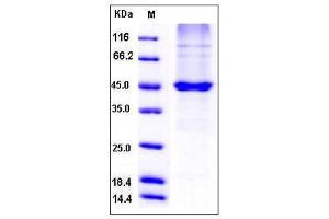 Image no. 1 for Paraoxonase 3 (PON3) (AA 1-354), (Ser50Asn-Mutant) protein (His tag) (ABIN2005397)