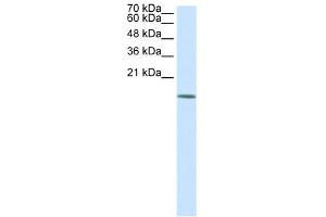 Image no. 2 for anti-Histone Deacetylase 6 (HDAC6) (N-Term) antibody (ABIN2777306)