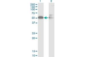 Image no. 2 for anti-alpha-2-HS-Glycoprotein (AHSG) (AA 19-367) antibody (ABIN513214)