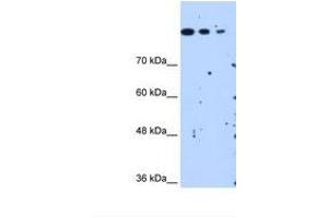 Image no. 2 for anti-SET Domain Containing 2 (SETD2) (AA 323-372) antibody (ABIN321311)