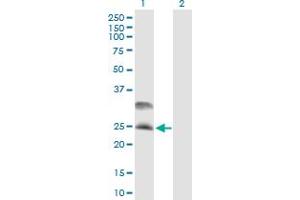 Western Blot analysis of DNAJC5 expression in transfected 293T cell line by DNAJC5 MaxPab polyclonal antibody.