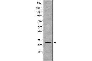 Image no. 2 for anti-NFKB Inhibitor Interacting Ras-Like 1 (NKIRAS1) antibody (ABIN6263642)