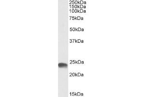 Image no. 1 for anti-Glutathione S-Transferase alpha 3 (GSTA3) (C-Term) antibody (ABIN6391398)