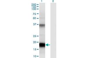 Western Blot analysis of UBD expression in transfected 293T cell line by UBD monoclonal antibody (M01), clone 7D8.