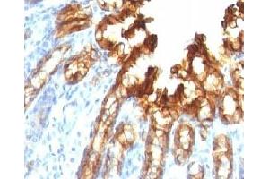 Immunohistochemistry (Formalin-fixed Paraffin-embedded Sections) (IHC (fp)) image for anti-Keratin 19 (KRT19) antibody (ABIN3025844)