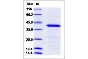 Image no. 1 for Nucleophosmin (Nucleolar phosphoprotein B23, Numatrin) (NPM1) (AA 2-294) protein (His tag) (ABIN2693527)