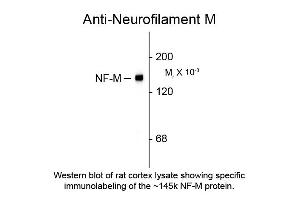 Image no. 1 for anti-Neurofilament Triplet M Protein (NEFM) (C-Term) antibody (ABIN6658051)