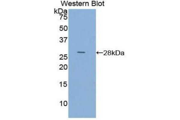 ACTC1 antibody  (AA 156-368)