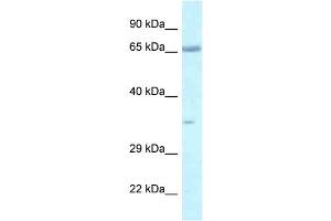 Image no. 1 for anti-Leucine Zipper, Putative Tumor Suppressor 1 (LZTS1) (C-Term) antibody (ABIN2777629)
