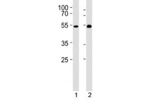 Image no. 5 for anti-Lymphocyte-Specific Protein tyrosine Kinase (LCK) (AA 23-52) antibody (ABIN3031644)