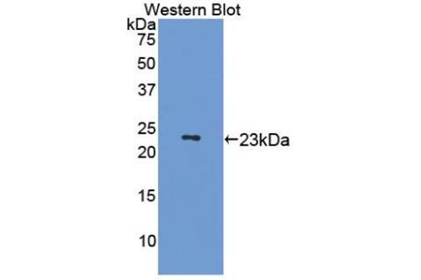 anti-Microtubule-Associated Protein 4 (MAP4) (AA 882-1062) antibody