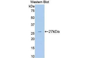 Image no. 1 for anti-Plasminogen (PLG) (AA 582-812) antibody (ABIN1078447)