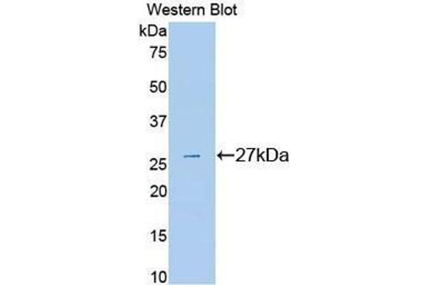 PLG anticorps  (AA 582-812)