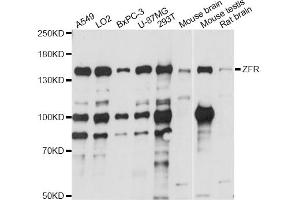 Image no. 1 for anti-Zinc Finger RNA Binding Protein (ZFR) antibody (ABIN6291122)