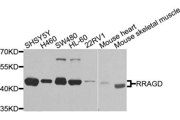 RRAGD antibody  (AA 181-400)