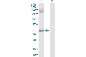 Image no. 1 for anti-Dickkopf Homolog 4 (Xenopus Laevis) (DKK4) (AA 1-224) antibody (ABIN525852)