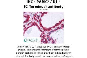 Image no. 1 for anti-Parkinson Protein 7 (PARK7) (C-Term) antibody (ABIN1737866)