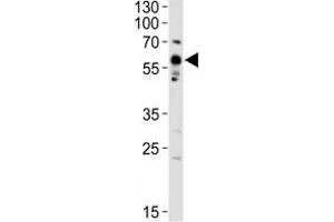 Image no. 3 for anti-Proto-oncogene tyrosine-protein kinase Src (Src) (AA 397-424) antibody (ABIN3029553)