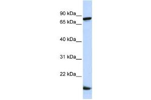 Image no. 1 for anti-Zinc Finger Protein 281 (ZNF281) antibody (ABIN2458356)