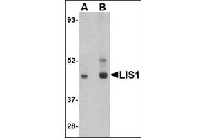 Image no. 2 for anti-Platelet-Activating Factor Acetylhydrolase 1b, Regulatory Subunit 1 (45kDa) (PAFAH1B1) (C-Term) antibody (ABIN500180)