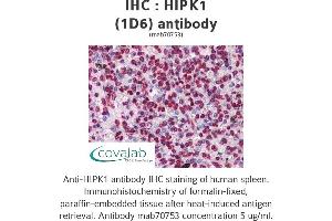 Image no. 2 for anti-Homeodomain Interacting Protein Kinase 1 (HIPK1) (AA 330-430) antibody (ABIN1723610)