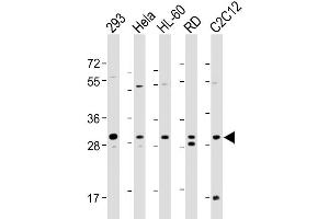 Image no. 6 for anti-Eukaryotic Translation Initiation Factor 4E Family Member 2 (EIF4E2) antibody (ABIN650677)