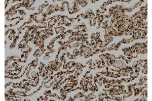 ABIN6272990 at 1/100 staining Human lung tissue by IHC-P.