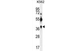 Image no. 2 for anti-Melanoma Antigen Family A, 12 (MAGEA12) antibody (ABIN3002530)
