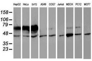 Image no. 12 for anti-Iduronate 2-Sulfatase (IDS) antibody (ABIN1498798)