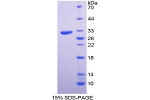 Image no. 1 for Discoidin Domain Receptor tyrosine Kinase 2 (DDR2) (AA 578-817) protein (His tag) (ABIN6237840)