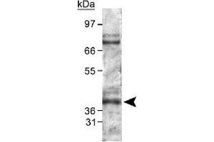 Image no. 2 for anti-Egl-9 Family Hypoxia Inducible Factor 1 (EGLN1) antibody (ABIN540394)