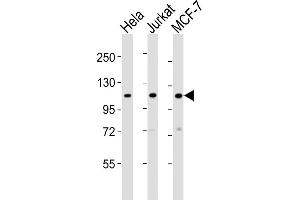 Sec8 anticorps  (N-Term)