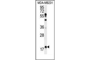 Image no. 2 for anti-Ras Homolog Enriched in Brain (RHEB) (AA 111-142), (C-Term) antibody (ABIN954537)