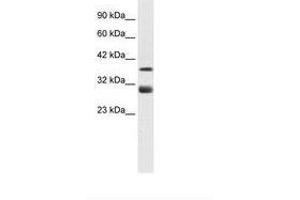 Image no. 2 for anti-T-Cell Acute Lymphocytic Leukemia 1 (TAL1) (AA 236-285) antibody (ABIN6735910)