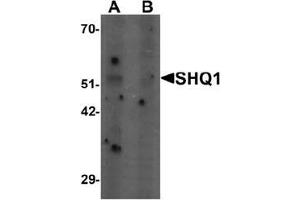 Image no. 1 for anti-SHQ1 Homolog (SHQ1) (N-Term) antibody (ABIN1449982)