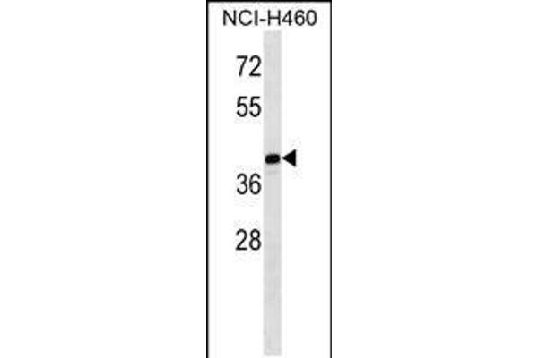 MAGEB10 antibody  (AA 88-116)