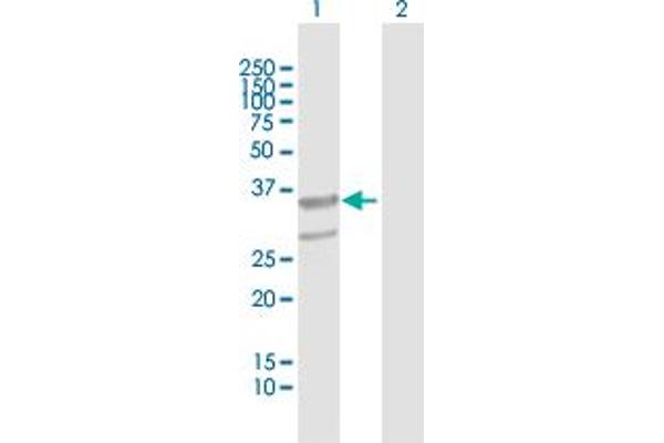 anti-Abhydrolase Domain Containing 11 (ABHD11) (AA 1-315) antibody