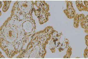 Image no. 1 for anti-Calpain 6 (CAPN6) (Internal Region) antibody (ABIN6260450)