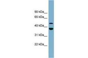 Image no. 1 for anti-Chromosome 4 Open Reading Frame 20 (C4orf20) (AA 395-444) antibody (ABIN6744146)