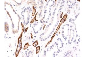 Image no. 1 for anti-Complement Component C4b (C4b) antibody (ABIN6940809)