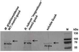 Image no. 1 for anti-Glucuronidase, beta (GUSB) antibody (ABIN458831)