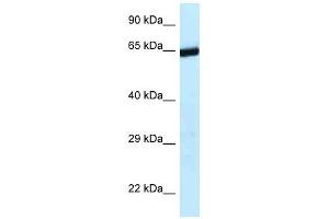 Image no. 1 for anti-Excision Repair Cross-Complementing Rodent Repair Deficiency, Complementation Group 6-Like 2 (ERCC6L2) (C-Term) antibody (ABIN927636)