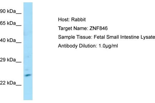 anti-Zinc Finger Protein 846 (ZNF846) (N-Term) antibody